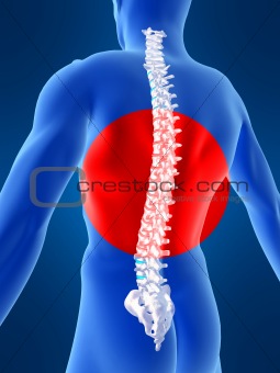 painful spine