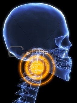 x-ray neck inflammation