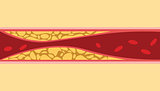 un healthy cholesterol human blood vein cell stream flow with fat on side with flat style illustration