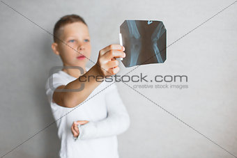 The boy with a broken hand looks at the X-ray. X-ray in the hands of a sad boy with a broken arm.