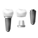 Component parts of dental implant - teeth denture