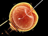 Artificial insemination. Needle puncture the cell membrane