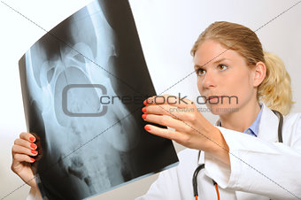 Female doctor examining an x-ray image