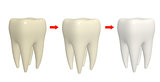 Process of cleaning teeth