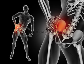 3D male figure holding hip in pain with close up of hip bone