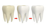 Process of cleaning teeth