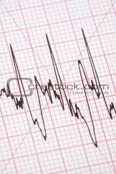 Printout from cardiograph