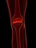 x-ray - skeletal knee