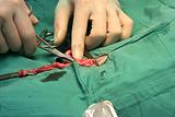 Surgical procedure